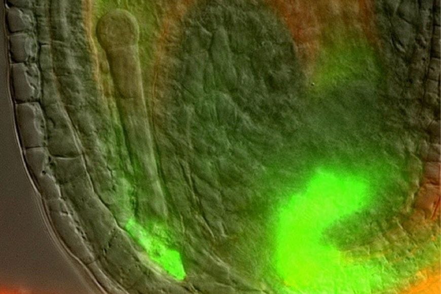 Arabidopsis developing seed: Auxin (here visualized in green) is produced and accumulates in the maternal tissue close to the young embryo. © Chulmin Park