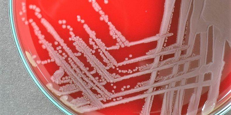 The new soil microorganism has been named Pseudomonas gregormendelii after Johann Gregor Mendel, the father of genetics.